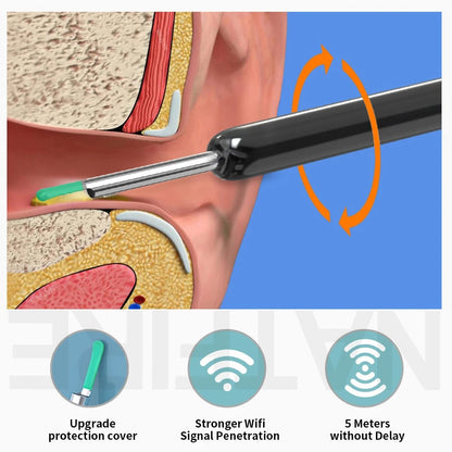 High-definition intelligent visual ear picking spoon